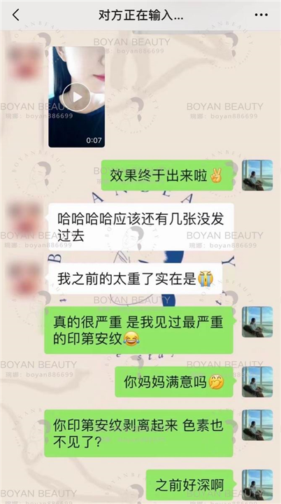 剥离微整