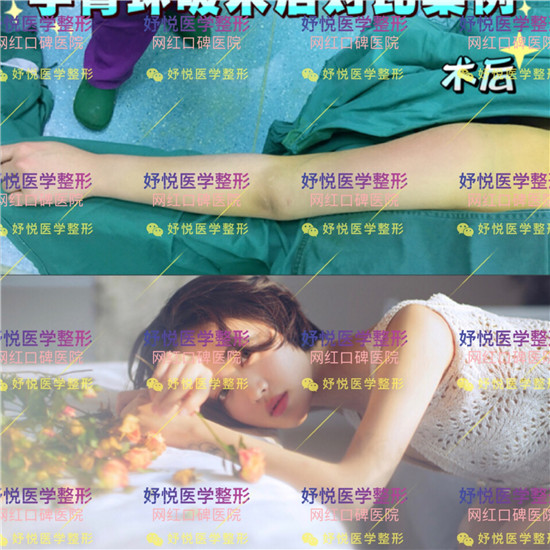 妤悦整形吸脂瘦身