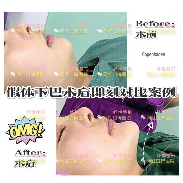 妤悦医疗美容|成都网红整形