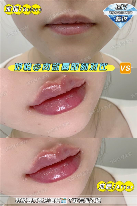 妤悦医疗美容
