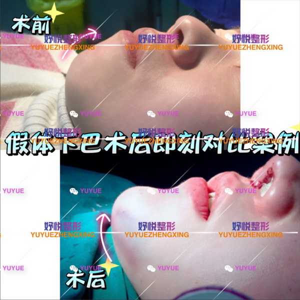成都鼻综合整形|成都眼综合整形
