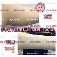 妤悦整形吸脂瘦身