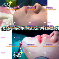 成都鼻综合整形|成都眼综合整形