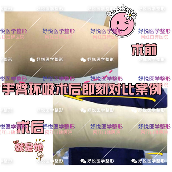 妤悦整形吸脂瘦身