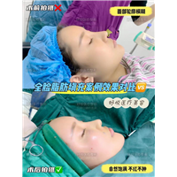 妤悦整形鼻综合