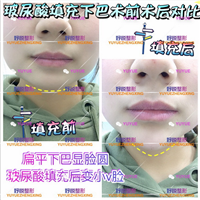 成都鼻综合整形|成都眼综合整形