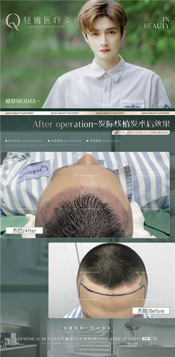 广州轻雅整形