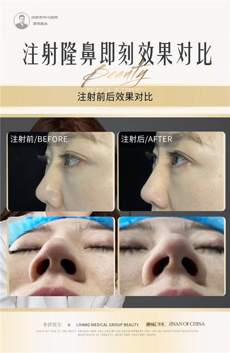 济南眼鼻整形医生