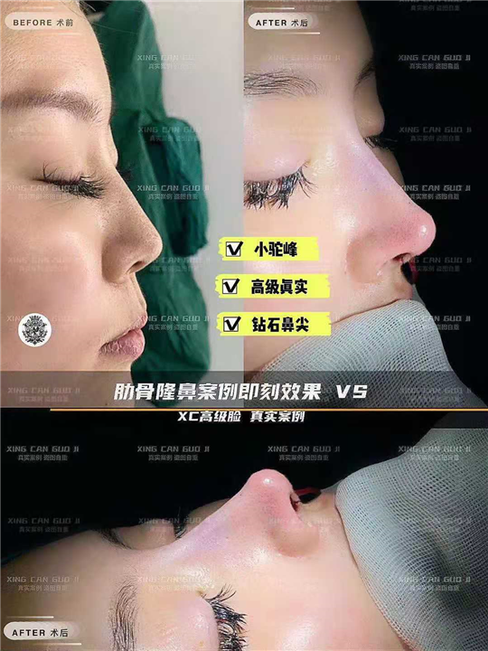 星璨国际