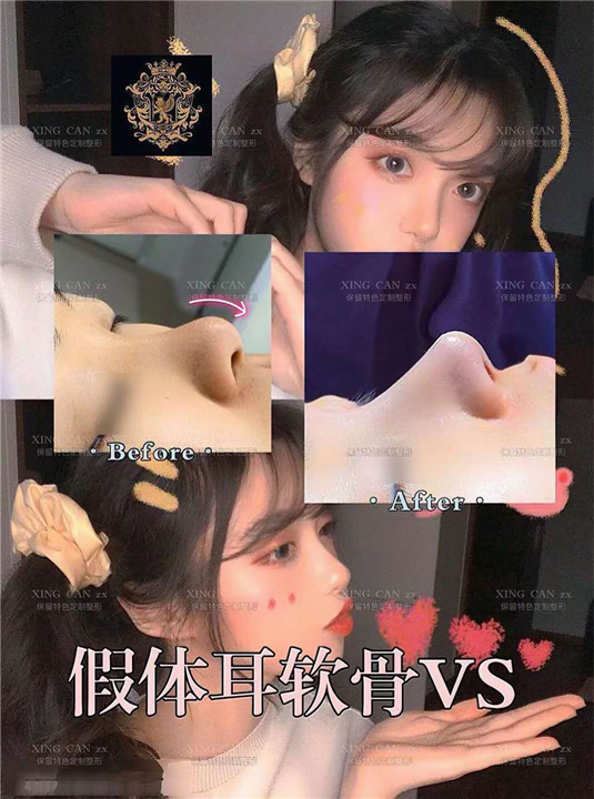 上海鼻整形修复医生