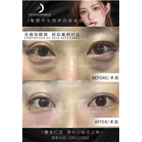 王子彦双眼皮