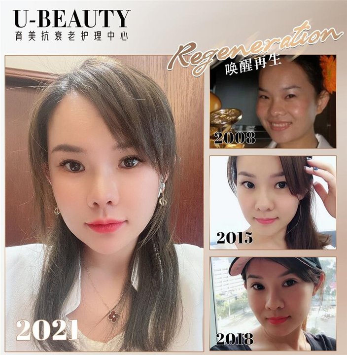 剥离微整安全吗