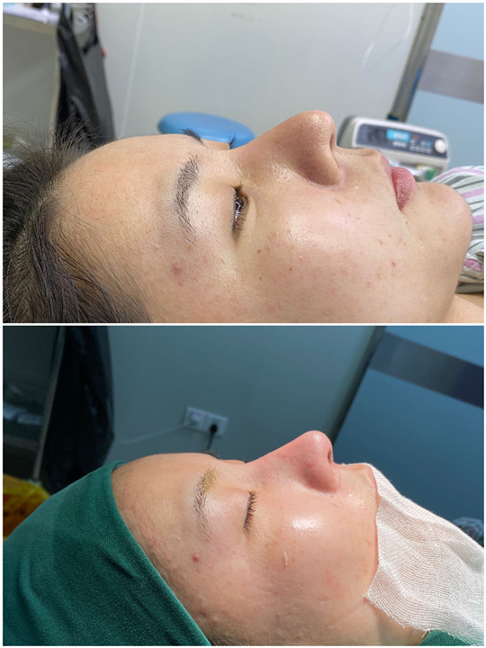 深圳鼻整形修复专家秦广安