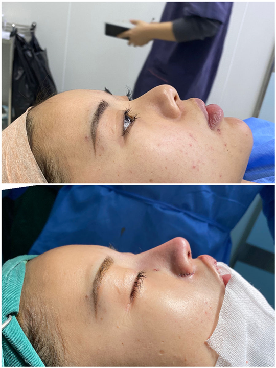 深圳秦广安耳软骨鼻综合