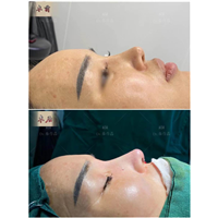 深圳鼻整形医生