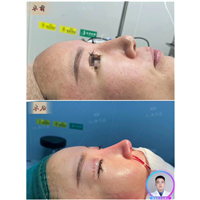 深圳鼻整形医生
