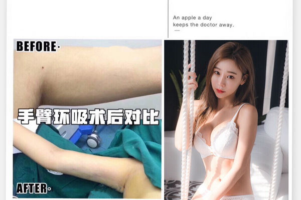抖音上上海网红整形医院