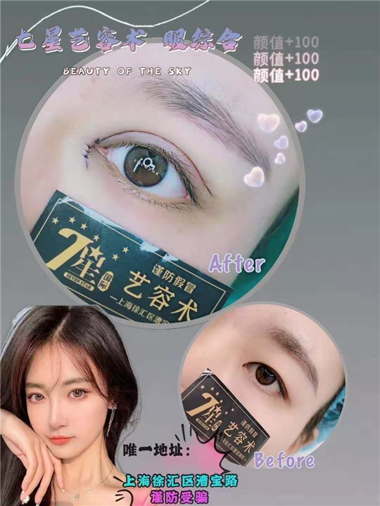 上海七星艺容术做眼综合整形好吗 