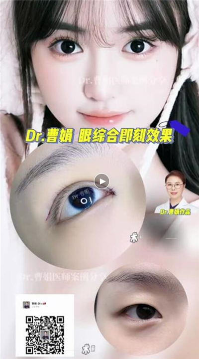 曹娟医生眼部案例