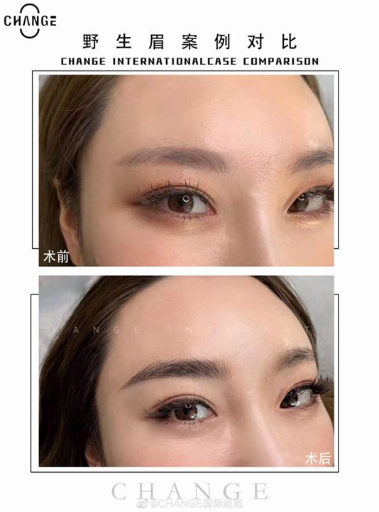 云南学半**哪家好 