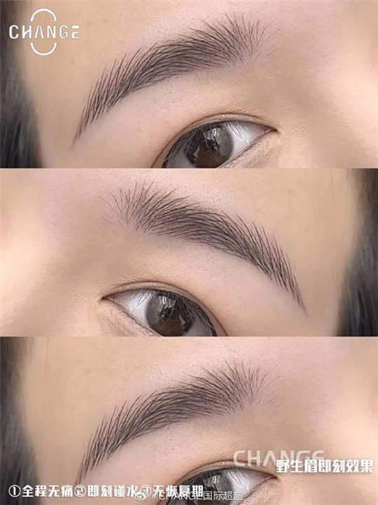 云南做半**哪家好 