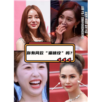 为什么猫咪纹会火上热搜？你有同款纹路吗？