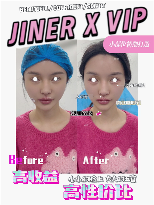 JINER医疗美容