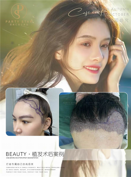 北京星美汇整形