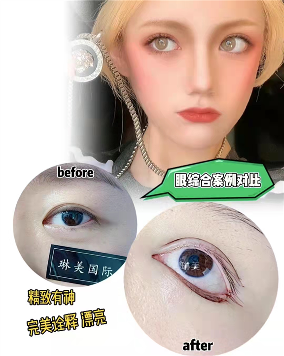 上海眼综合整形多少钱