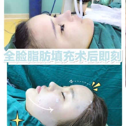 西安网红整形医院 