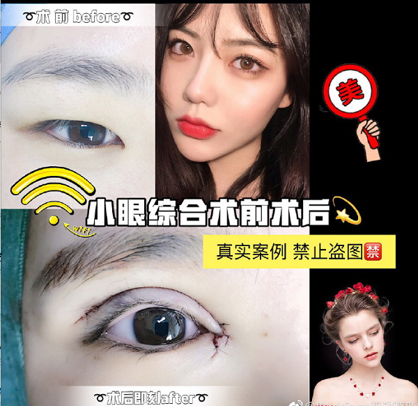 西安网红全脸打造 