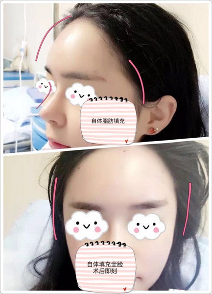 西安眼综合整形 