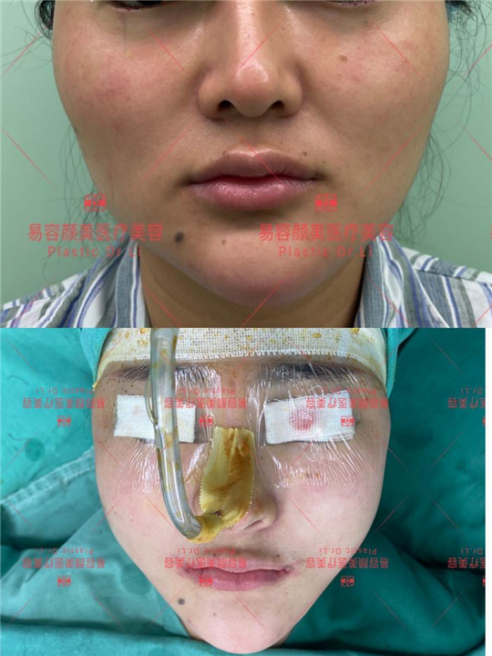 易容颜美李医生