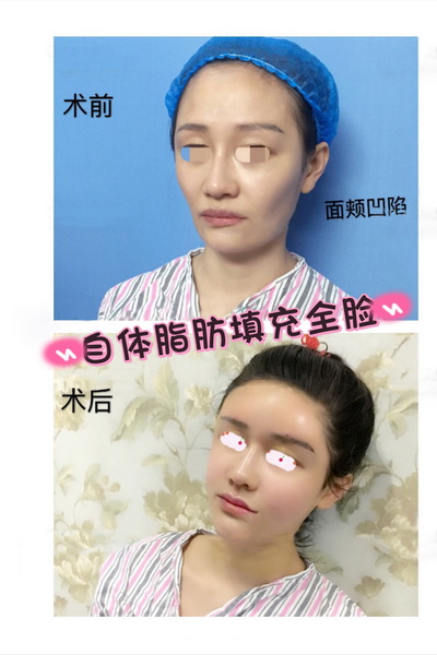 西安网红整形医院 