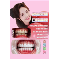 上海全瓷贴片美牙