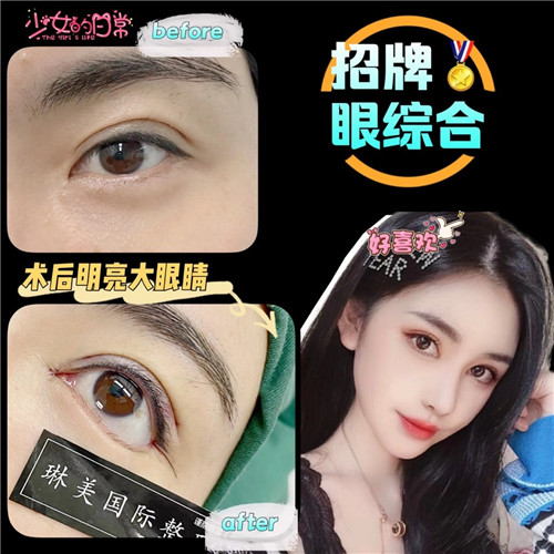 上海琳美眼综合整形