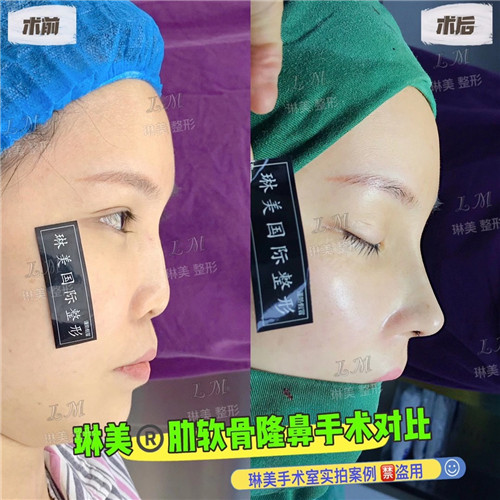 上海琳美鼻综合整形