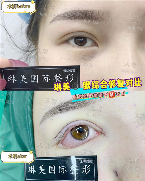 上海琳美眼综合整形