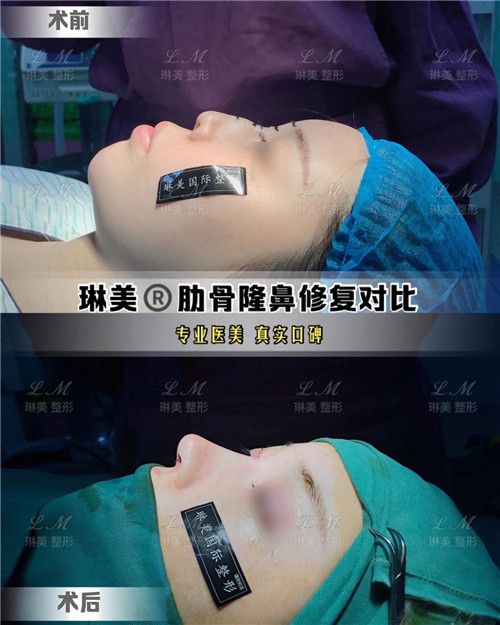 上海琳美鼻综合整形