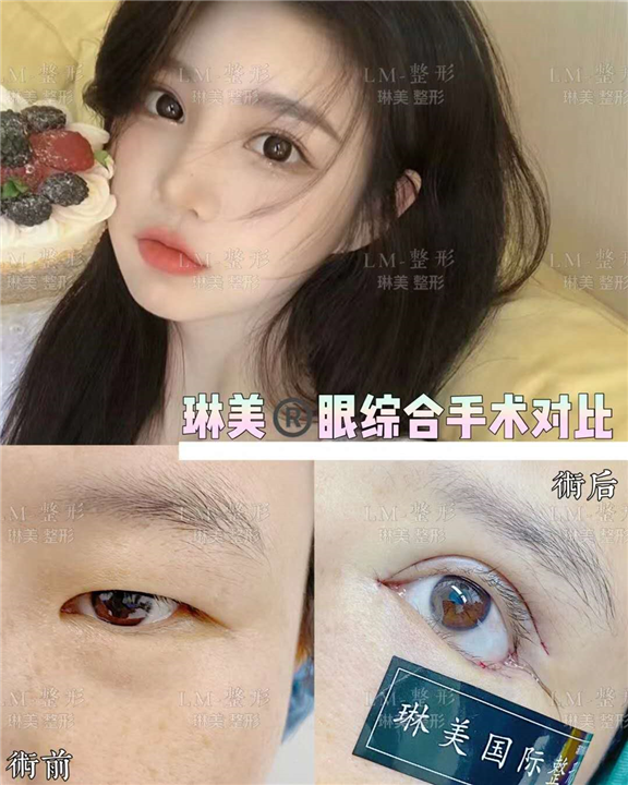 上海琳美眼综合整形