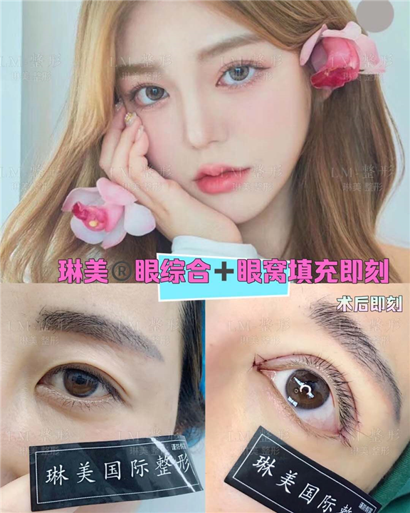上海眼综合整形专家