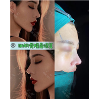 上海琳美鼻综合整形