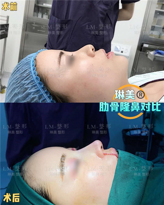 上海琳美鼻综合整形