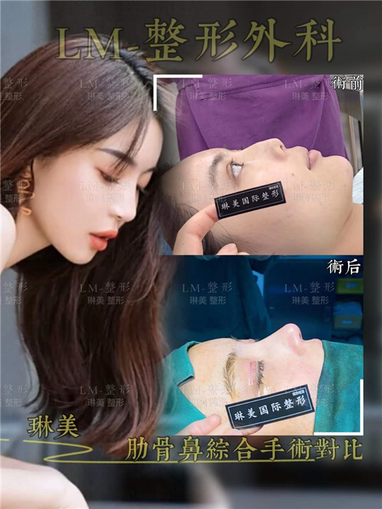 上海琳美鼻综合整形