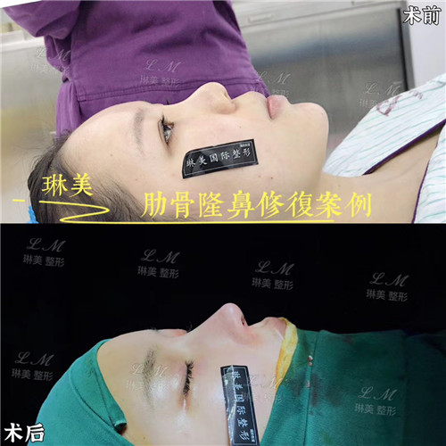 上海琳美鼻综合整形