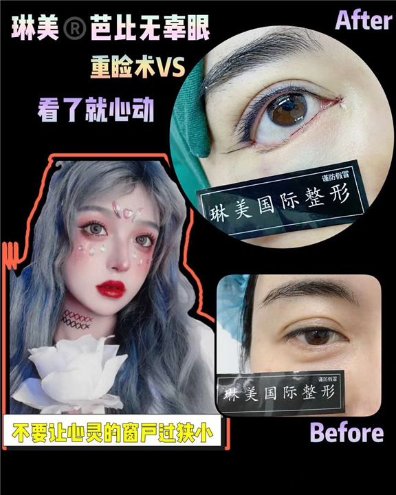 上海琳美眼综合整形