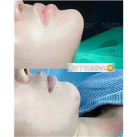 上海中韩国际整形医院