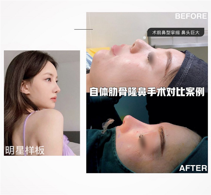 上海七星艺容术整形怎么样?技术好不好 
