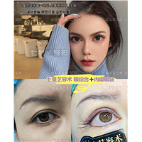 上海七星艺容术眼综合