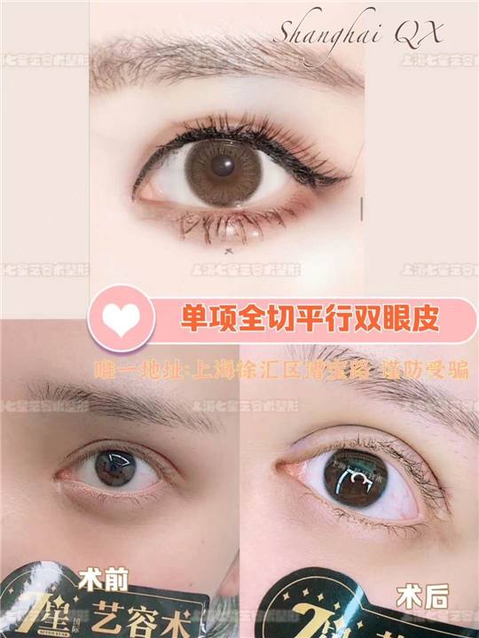 七星艺容术整形好不好